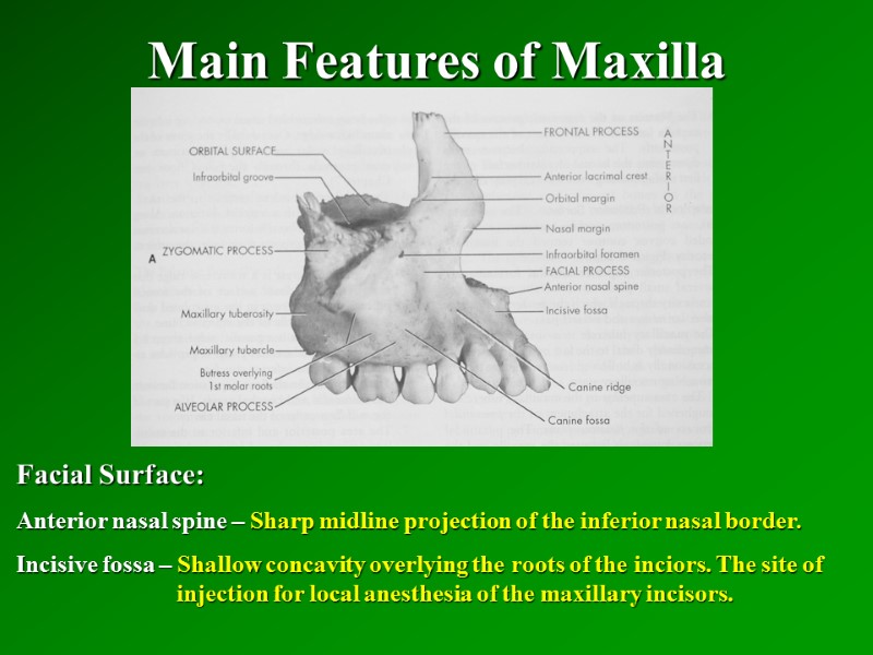 Main Features of Maxilla   Facial Surface: Anterior nasal spine – Sharp midline